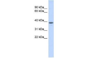 WDR21B antibody used at 1 ug/ml to detect target protein. (DCAF4L1 抗体  (Middle Region))