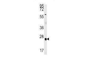 RBM24 antibody  (N-Term)