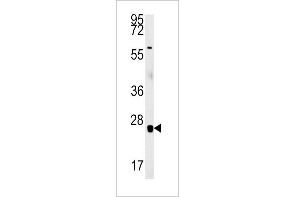 RBM24 antibody  (N-Term)