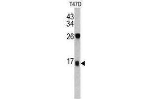 Image no. 1 for anti-Dermcidin (DCD) (C-Term) antibody (ABIN452901) (Dermcidin 抗体  (C-Term))