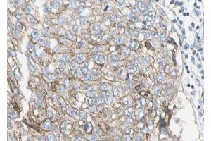 Immunohistochemistry (IHC) image for anti-Plasminogen Activator Inhibitor 1 (SERPINE1) (Internal Region) antibody (ABIN6264015)