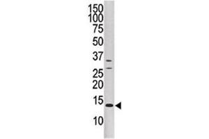 Western blot analysis of DUSP15 antibody and CEM cell line lysate. (DUSP15 抗体  (AA 17-44))