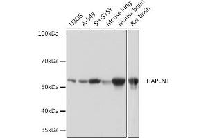 Western blot analysis of extracts of various cell lines, using H Rabbit mAb (ABIN7267797) at 1:1000 dilution. (HAPLN1 抗体)