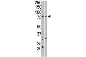 cGKI beta antibody used in western blot to detect cGKIbeta in 293 cell lysate (Lane 1) and mouse small intestine tissue lysate (2).