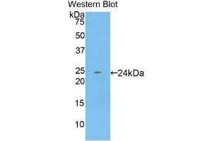 Detection of Recombinant KRT18, Human using Monoclonal Antibody to Cytokeratin 18 (CK18) (Cytokeratin 18 抗体  (AA 238-396))