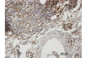 Immunoperoxidase of purified MaxPab antibody to SH3KBP1 on formalin-fixed paraffin-embedded human lymph node. (SH3KBP1 抗体  (AA 1-665))