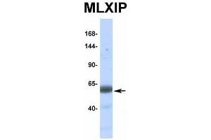 Host:  Rabbit  Target Name:  MLXIP  Sample Type:  Human Fetal Muscle  Antibody Dilution:  1.