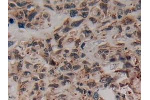 Immunohistochemistry (IHC) image for anti-Corticotropin Releasing Hormone (CRH) (AA 40-195) antibody (ABIN7429697)