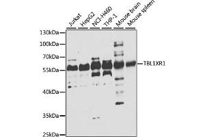 Western blot analysis of extracts of various cell lines, using TBL1XR1 antibody (ABIN6132718, ABIN6148894, ABIN6148896 and ABIN6223805) at 1:1000 dilution. (TBL1XR1 抗体  (AA 1-180))