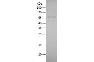 CDH18 Protein (AA 54-608) (His tag)