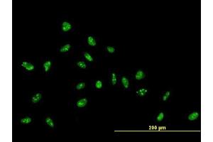 Immunofluorescence of purified MaxPab antibody to ZNF593 on HeLa cell. (ZNF593 抗体  (AA 1-116))
