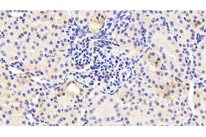 Immunohistochemistry (IHC) image for anti-serine Peptidase Inhibitor, Kazal Type 5 (SPINK5) (AA 699-976) antibody (ABIN7436423)