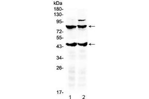 Western blot testing of 1) rat brain and 2) mouse brain lysate with TSH Receptor antibody. (TSHR, B Chain 抗体  (AA 515-538))