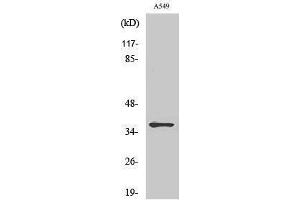 Western Blotting (WB) image for anti-Mitochondrially Encoded NADH Dehydrogenase 1 (MT-ND1) (Internal Region) antibody (ABIN3185785)