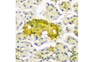 IHC analysis of ATP citrate lyase using anti-ATP citrate lyase antibody (ABIN6719406). (ACLY 抗体  (AA 1-180))