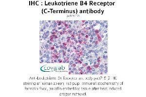 Image no. 1 for anti-Leukotriene B4 Receptor (LTB4R) (C-Term) antibody (ABIN1736425) (Leukotriene B4 Receptor/BLT 抗体  (C-Term))