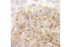 Immunohistochemistry (IHC) image for anti-Eukaryotic Translation Initiation Factor 4 gamma 2 (EIF4G2) (AA 125-175) antibody (ABIN7454440)