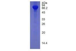 Image no. 1 for Histidine-Rich Glycoprotein (HRG) (AA 19-525) (Active) protein (His tag) (ABIN6239796)