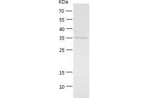 Western Blotting (WB) image for rho-Associated, Coiled-Coil Containing Protein Kinase 1 (ROCK1) (AA 317-627) protein (His tag) (ABIN7124866) (ROCK1 Protein (AA 317-627) (His tag))