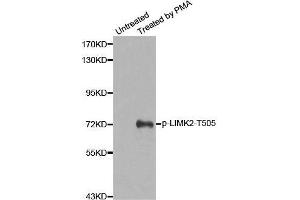 Western blot analysis of extracts from Hela cells, using Phospho-LIMK2-T505 antibody. (LIMK2 抗体  (pThr505))