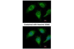 ICC/IF Image Immunofluorescence analysis of methanol-fixed HeLa, using Annexin A4, antibody at 1:200 dilution. (Annexin IV 抗体)