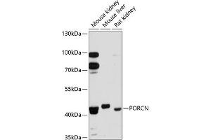 Western blot analysis of extracts of various cell lines, using PORCN antibody (ABIN6131340, ABIN6145972, ABIN6145974 and ABIN6215858) at 1:3000 dilution. (PORCN 抗体  (AA 220-320))