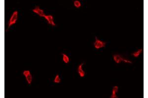Immunofluorescence (fixed cells) (IF/ICC) image for anti-Zinc Finger, DHHC-Type Containing 9 (ZDHHC9) (C-Term) antibody (ABIN6261286)