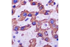 Immunohistochemistry (IHC) image for anti-Ribosomal Protein L14 (RPL14) antibody (ABIN7308284) (RPL14 抗体)