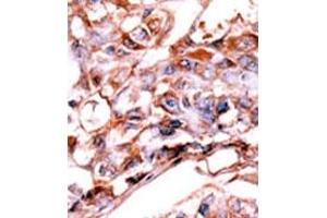 Image no. 2 for anti-V-Erb-A erythroblastic Leukemia Viral Oncogene Homolog 4 (Avian) (ERBB4) (pTyr1188) antibody (ABIN358140) (ERBB4 抗体  (pTyr1188))