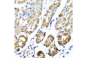 Immunohistochemistry of paraffin-embedded human stomach using HY antibody  at dilution of 1:100 (40x lens). (HYAL1 抗体  (AA 136-435))