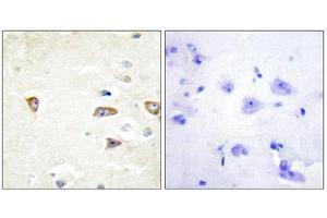 Immunohistochemistry (IHC) image for anti-CDC42 Binding Protein Kinase beta (DMPK-Like) (CDC42BPB) (C-Term) antibody (ABIN1850128) (CDC42BPB 抗体  (C-Term))