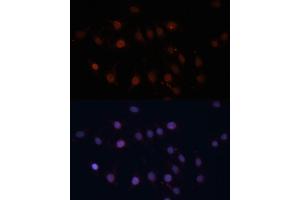Immunofluorescence analysis of C6 cells using TOM70 antibody (ABIN1683089, ABIN3018839, ABIN3018840 and ABIN6220597) at dilution of 1:100. (TOM70 抗体  (AA 60-340))