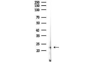 anti-RAB18, Member RAS Oncogene Family (RAB18) (Internal Region) antibody
