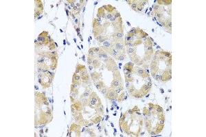 Immunohistochemistry of paraffin-embedded human gastric using CBR4 antibody at dilution of 1:100 (x40 lens). (CBR4 抗体)