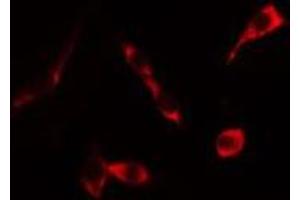 ABIN6276324 staining HeLa cells by IF/ICC. (KRT20 抗体  (C-Term))