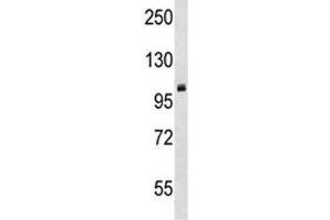 PRMT10 antibody western blot analysis in mouse cerebellum tissue lysate. (PRMT10 抗体  (AA 39-68))