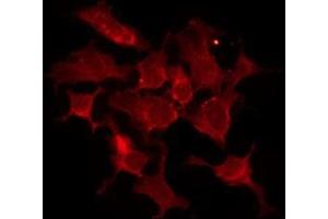 ABIN6278602 staining Hela by IF/ICC. (OR13C2/13C9 抗体)
