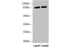 Western blot All lanes: MAGED1 antibody at 5. (MAGED1 抗体  (AA 579-778))
