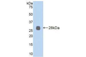 Western blot analysis of recombinant Human LOXL2. (LOXL2 抗体  (AA 544-751))