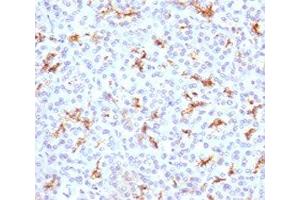 IHC testing of FFPE human pancreas with CFTR antibody (clone CFTR1-1).