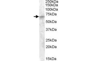 IGF2BP2 polyclonal antibody  (1 ug/mL) staining of HepG2 cell lysate (35 ug protein in RIPA buffer). (IGF2BP2 抗体)