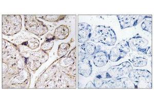 Immunohistochemistry (IHC) image for anti-Alkaline Ceramidase 3 (ACER3) (Internal Region) antibody (ABIN1850730) (ACER3 抗体  (Internal Region))