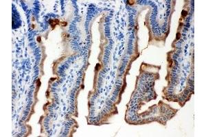 Immunohistochemistry (IHC) image for anti-Ovalbumin (OVA) (AA 1-350) antibody (ABIN3032105)