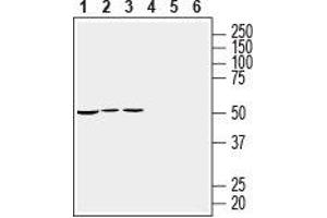 Western blot analysis of mouse heart membranes (lanes 1 and 4), rat heart lysate (lanes 2 and 5) and rat brain lysate (lanes 3 and 6): - 1-3. (RIC3 抗体  (C-Term, Intracellular))