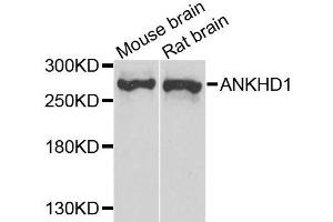 Western blot analysis of extracts of various cell lines, using ANKHD1 antibody. (ANKHD1 抗体  (AA 1620-1800))