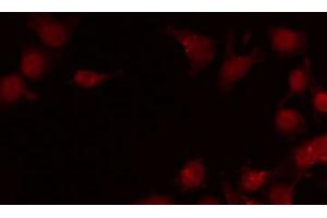 ABIN6269138 staining LOVO by IF/ICC. (SRF 抗体  (N-Term))