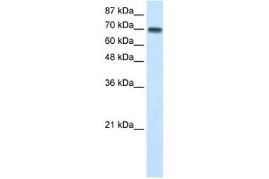 CARS antibody used at 1 ug/ml to detect target protein. (CARS 抗体  (N-Term))