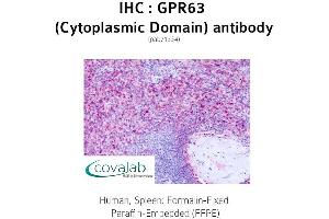 Image no. 2 for anti-G Protein-Coupled Receptor 63 (GPR63) (1st Cytoplasmic Domain) antibody (ABIN1735140)