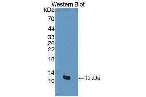 Detection of Recombinant GTF2H5, Human using Polyclonal Antibody to General Transcription Factor IIH, Polypeptide 5 (GTF2H5) (GTF2H5 抗体  (AA 1-71))