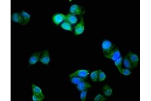 Immunofluorescence staining of Hela cells with ABIN7173574 at 1:200, counter-stained with DAPI. (TNNI3 抗体  (AA 2-210))